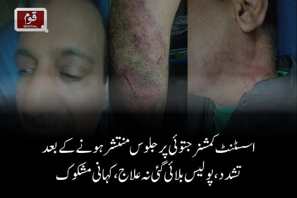 اسسٹنٹ کمشنر جتوئی پرجلوس منتشر ہونے کے بعد تشدد،پولیس بلائی گئی نہ علاج،کہانی مشکوک