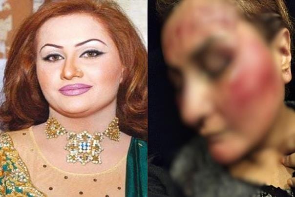 سٹیج اداکارہ نرگس پر شوہر کا تشدد